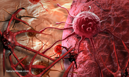 Ai cũng có tế bào ung thư trong cơ thể: 3 nguyên tắc vàng chặn đứng sự hình thành khối u