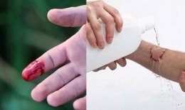 Nếu không may bị đứt tay thì đây chính xác là những gì bạn phải làm