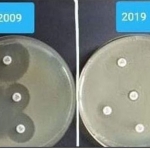 “Thử thách 10 năm” cho thấy vi khuẩn đã không còn đáp ứng với thuốc như trước