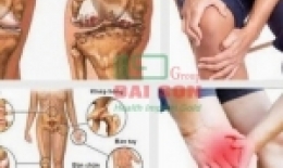 1001 căn bệnh về xương khớp