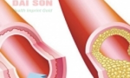 Có phải “bệnh khớp đớp tim”?