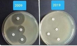 “Thử thách 10 năm” cho thấy vi khuẩn đã không còn đáp ứng với thuốc như trước
